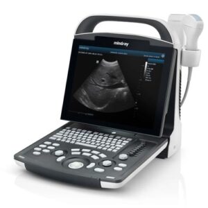 Digital Ultrasonic Diagnostic Imaging System